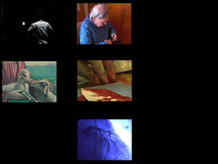 pericardium3