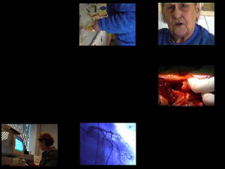pericardium7